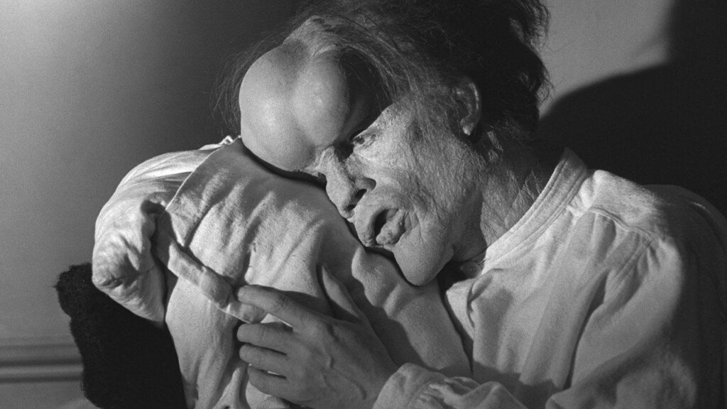 Кадр из фильма «Человек-слон (1980)»
